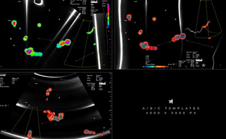 دانلود افکت لایه باز عکس اسکن Echo Scan