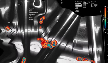 دانلود افکت لایه باز فتوشاپ اسکن Echo Scan