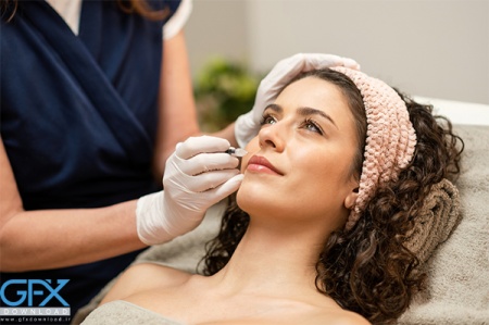 عکس تزریق ژل لب طبیعی