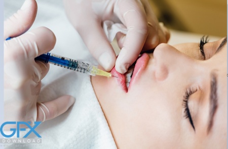 عکس تزریق ژل لب