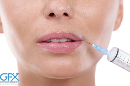 عکس تزریق ژل به لب