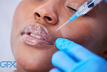 عکس بوتاکس لب