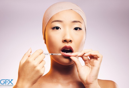 عکس تزریق ژل لب طبیعی