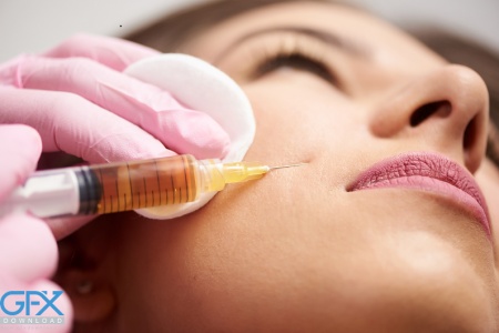 عکس تزریق ژل سیب گونه